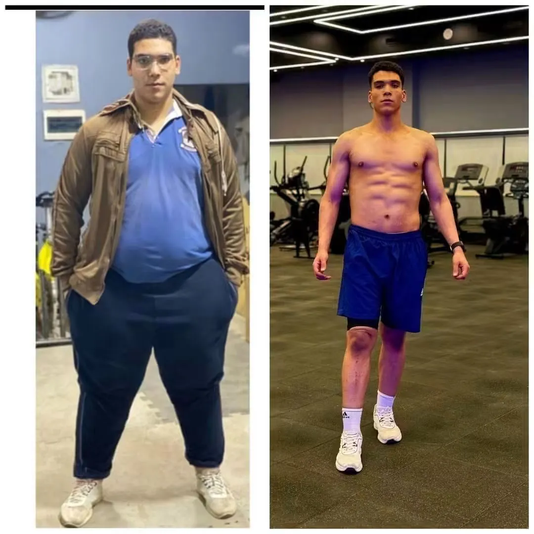 Ahmed M. transformation 1